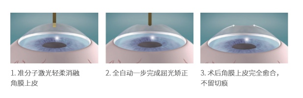 表层全激光.jpg